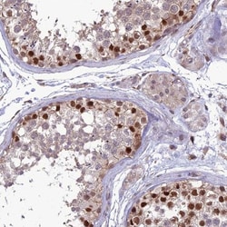 CINAP Antibody, Novus Biologicals 0.1mL; Unlabeled:Antibodies, Polyclonal